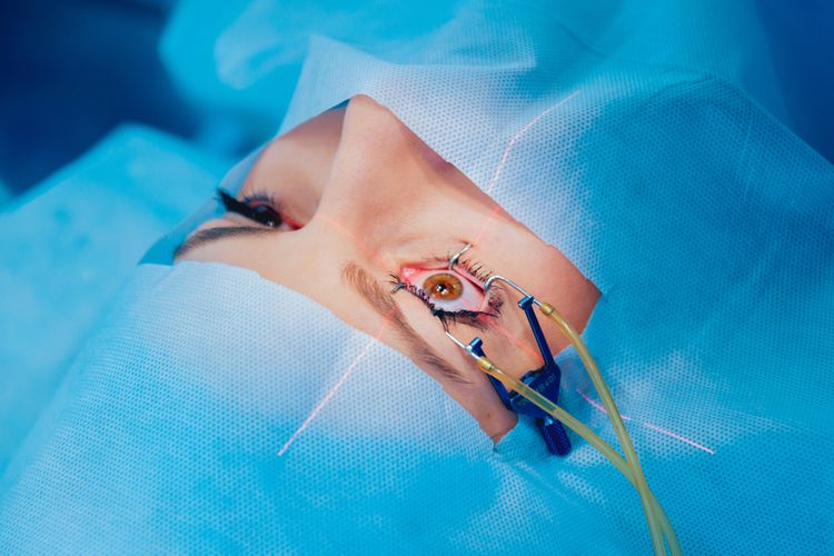 Apakah Boleh Main HP Setelah Lasik